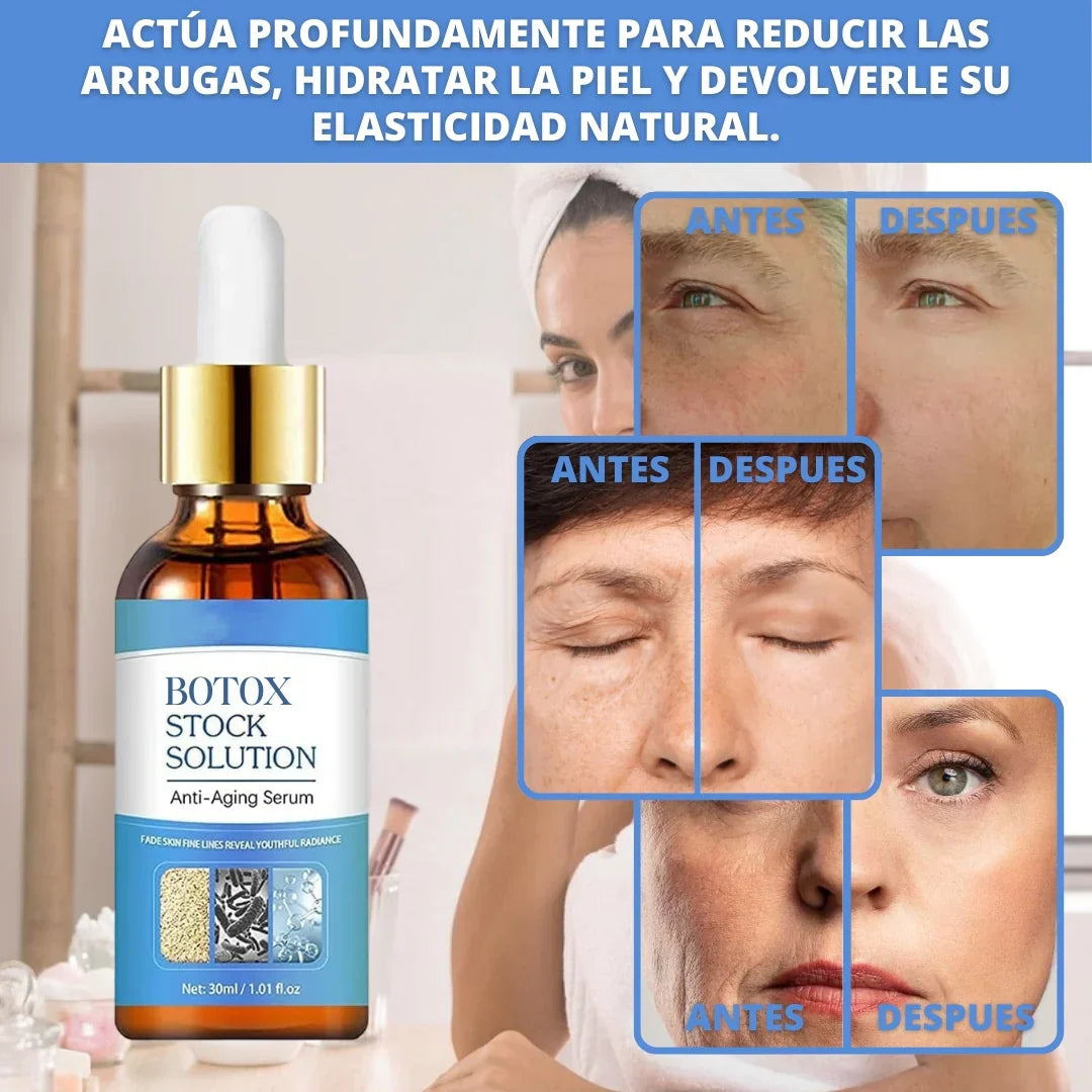 NUEVO SUERO ANTIARRUGAS BOTOX SOLUTION